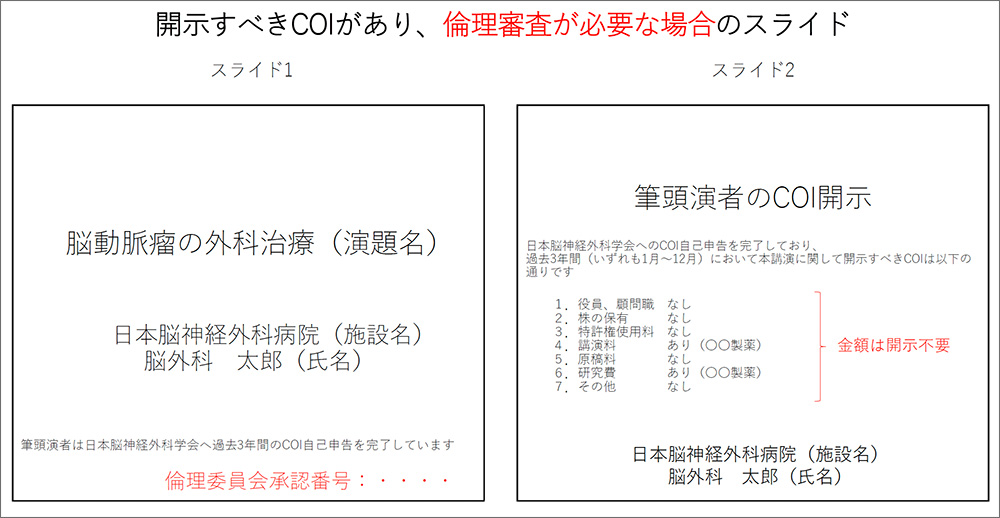開示すべきCOIがあり、倫理審査が必要な場合のスライド